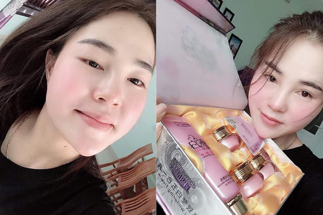 Kem trị nám Hoàng Cung có tốt không? Có bao nhiêu loại sản phẩm? hiểu việc sử dụng
